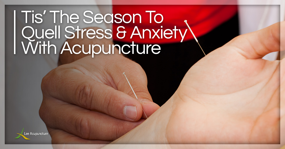 Tis-The-Season-To-Quell-Stress-And-Anxiety-With-Acupuncture-5be9b20d362f5