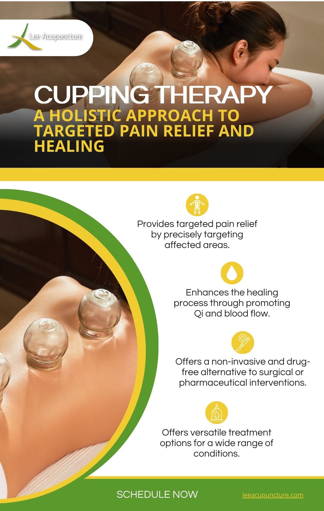 an infographic about cupping therapy