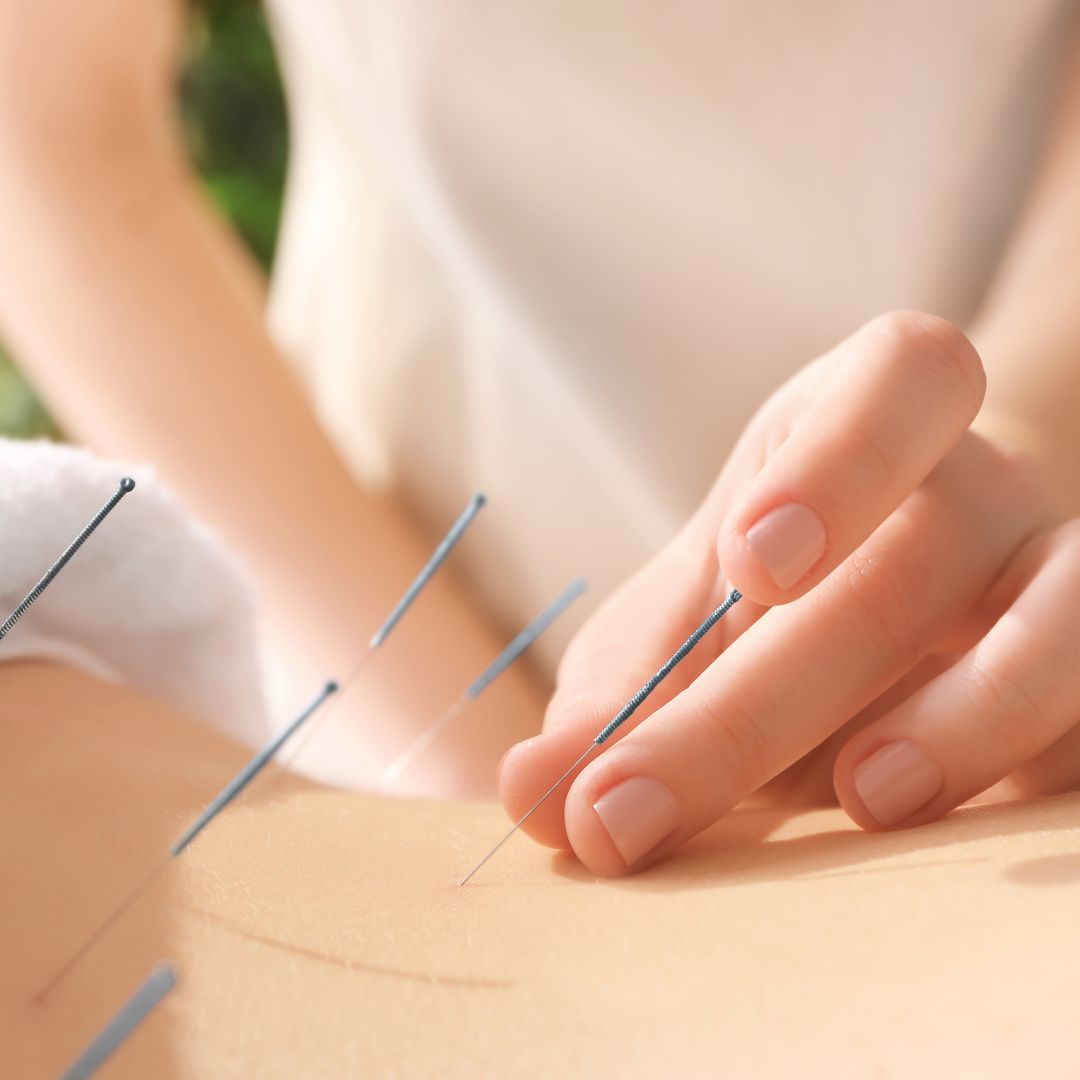 womens acupuncture